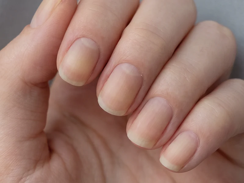 Dull Nails Lack Shine 